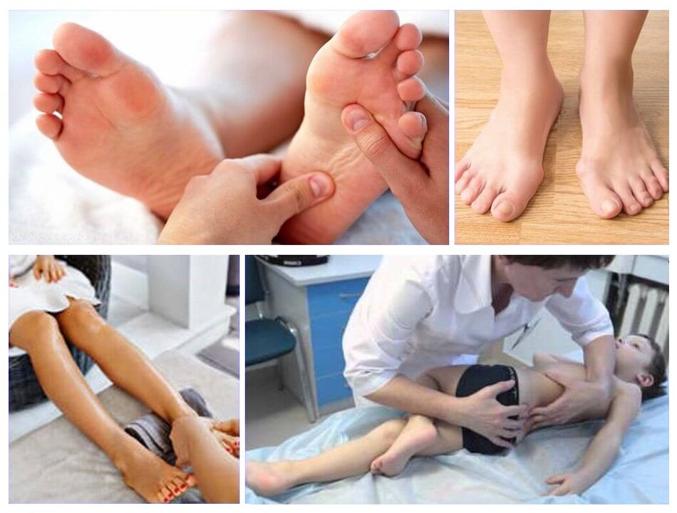 Valgus -Deformation bei der Behandlung von Kindern