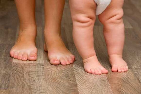 Valgus -Verformung bei Kindern