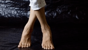 Valgus -Verformung